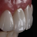 Detalhe porcelana